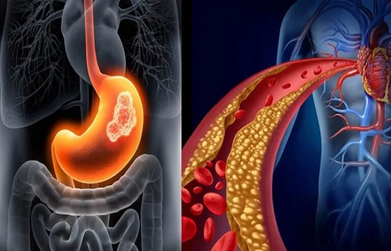 کس بلڈ گروپ میں کینسر کے خطرہ زیادہ ہوتا ہے؟
