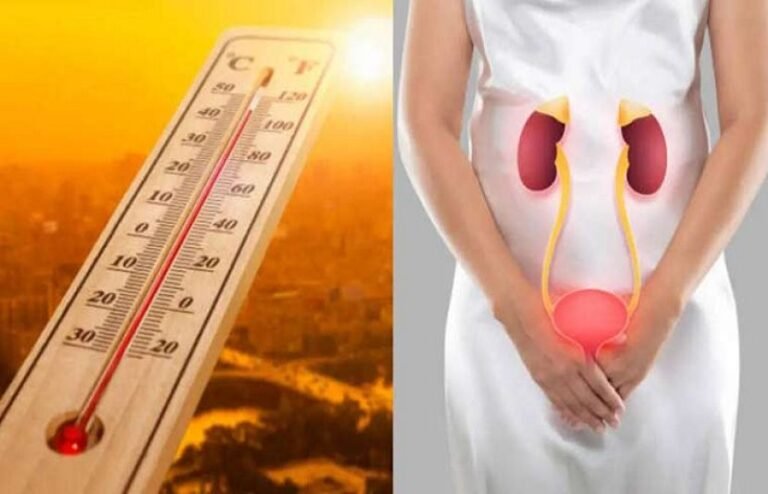 شدید گرمی میں گردوں کی حفاظت کیسے کریں؟