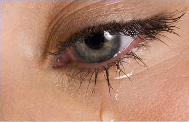 ہم روتے کیوں ہیں؟جانیے آنسوؤں کے پیچھے چھپی حیران کن سائنس 72 941a3d51de70a67c7e7122ec31ffedbb L