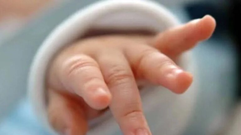 Karachi hospital staff, doctor booked after one-month-old’s hand amputated