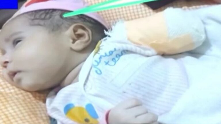 Baby’s hand amputated after alleged medical negligence in Karachi
