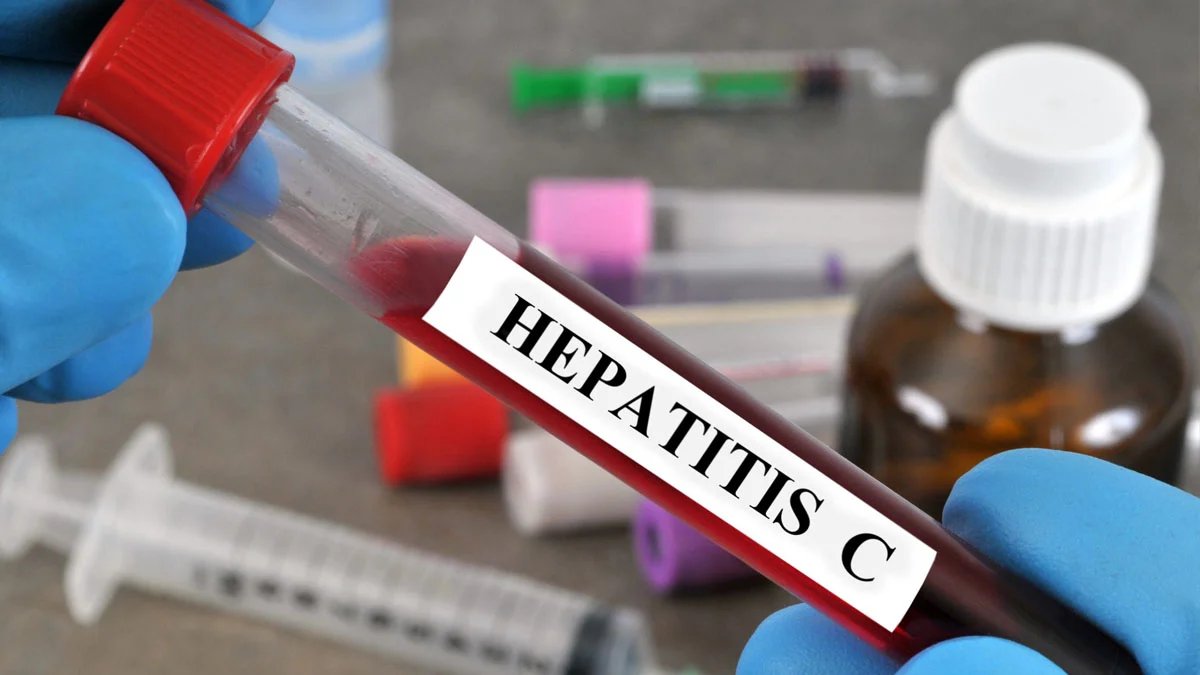 Hepatitis C