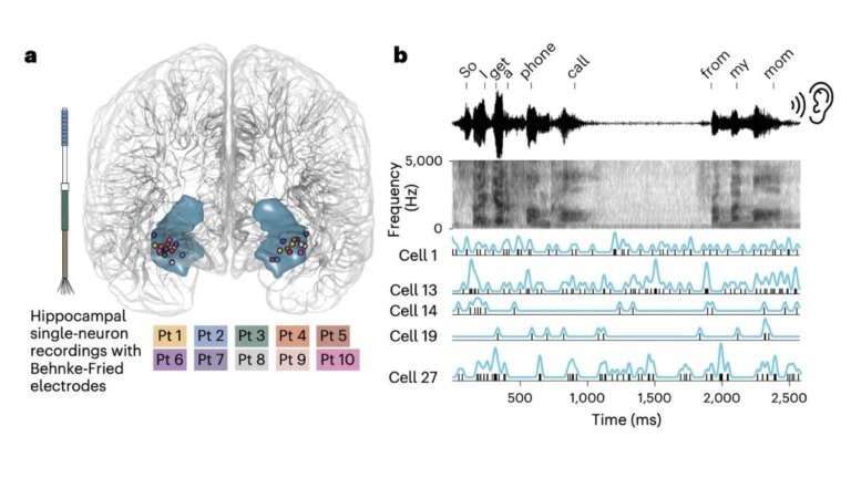 AI Study Reveals How the Human Brain Processes Spoken Words