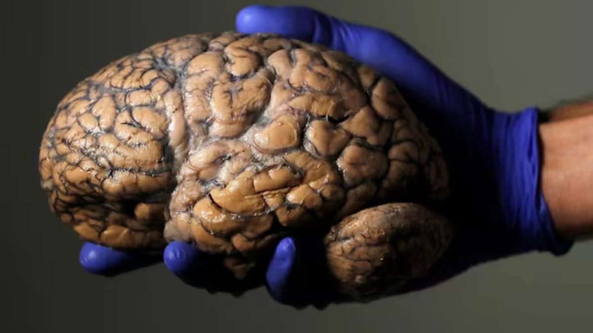Human brain is actually two separate organs Stanford study reveals
