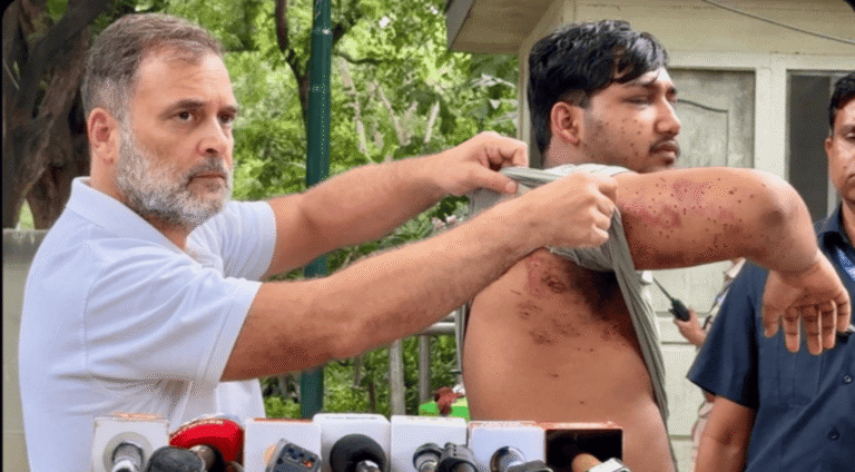 راہل گاندھی نے نوجوانوں پر تشدد کا معاملہ اٹھایا، ’پیلٹ‘ متاثرہ کو سامنے لا کر حکومت سے پوچھے سوال