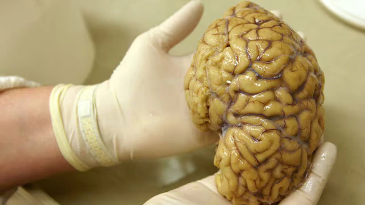 Scientists brain