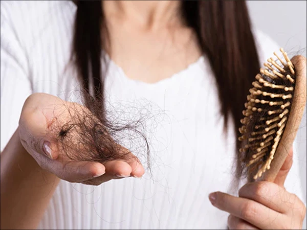 سردیوں میں بال زیادہ کیوں جھڑتے ہیں؟ کیا احتیاط کی جائے؟ 80 hair fall in winter1764862709 0