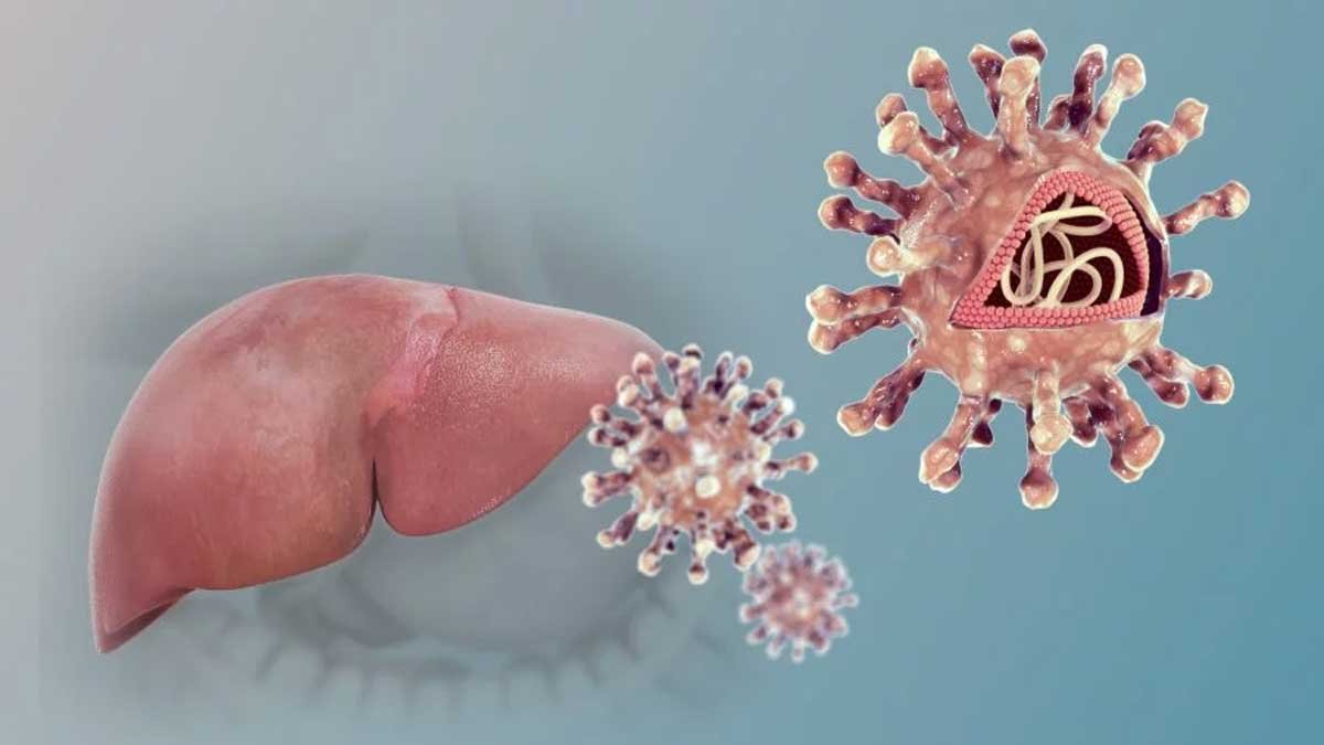 hepatitis
