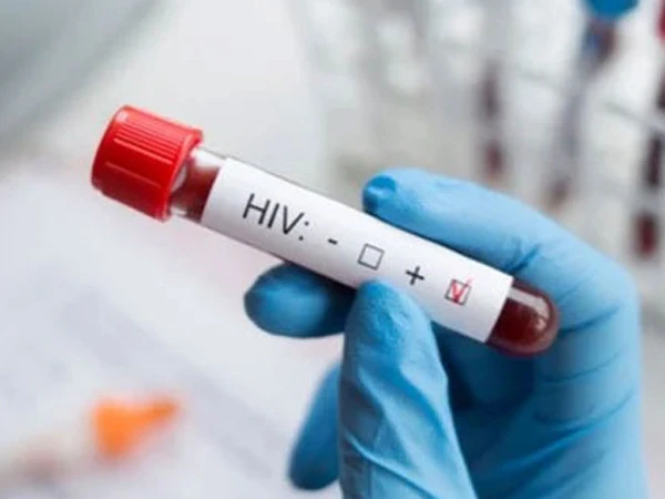 hiv1790358526 0