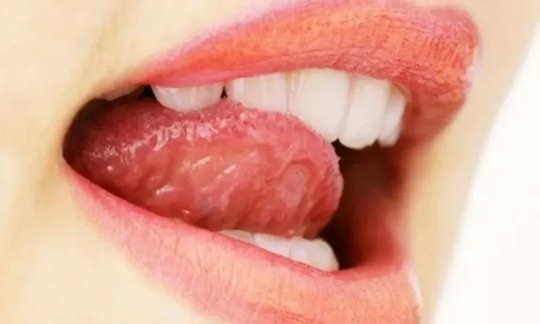 یہ عام سی عادات زبان کا ذائقہ بگاڑ سکتی ہیں