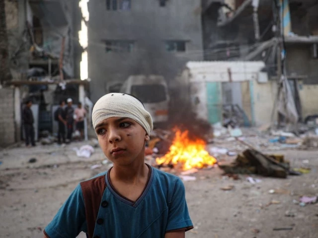 Many countries offer aid, staff to treat Gaza patients in West Bank | The Express Tribune
