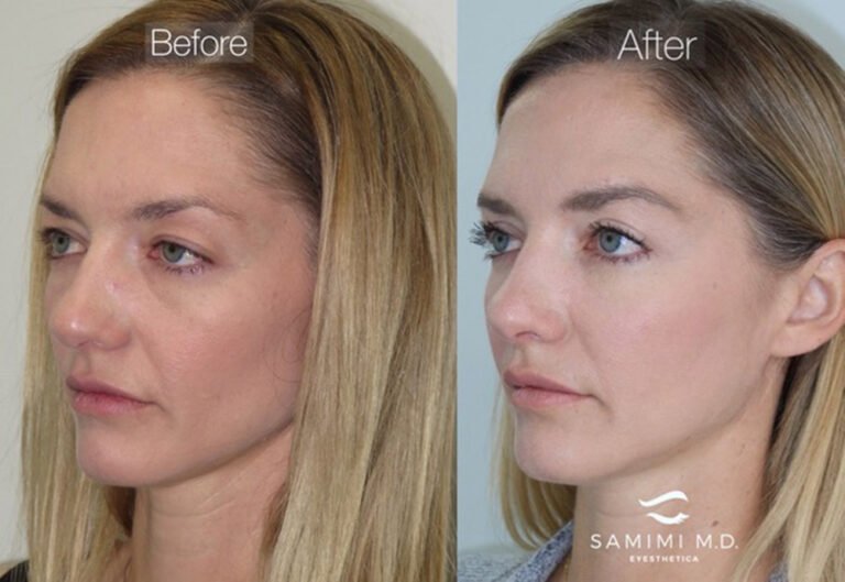 Hollywood’s New Favorite Skin Treatments Promise Age-Defying Results With Minimal Recovery Time