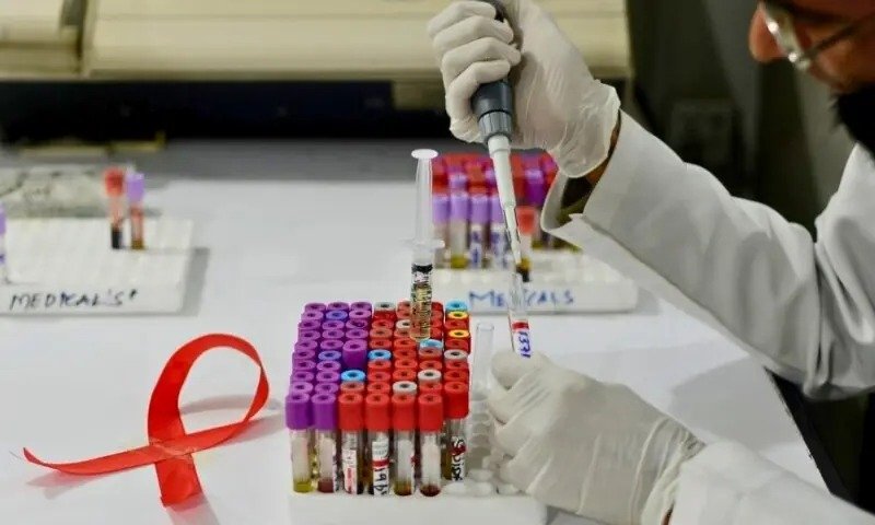Reuse of Syringes, Unsafe Medical Practices Fuel Rise in AIDS Cases in Pakistan 18 IMG 20260415 WA2288