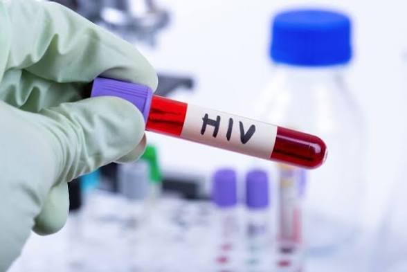 HIV Spreads in Islamabad: 618 New Cases Recorded in 15 Months, Children and Transgender Persons Among Victims 3 images 12 1