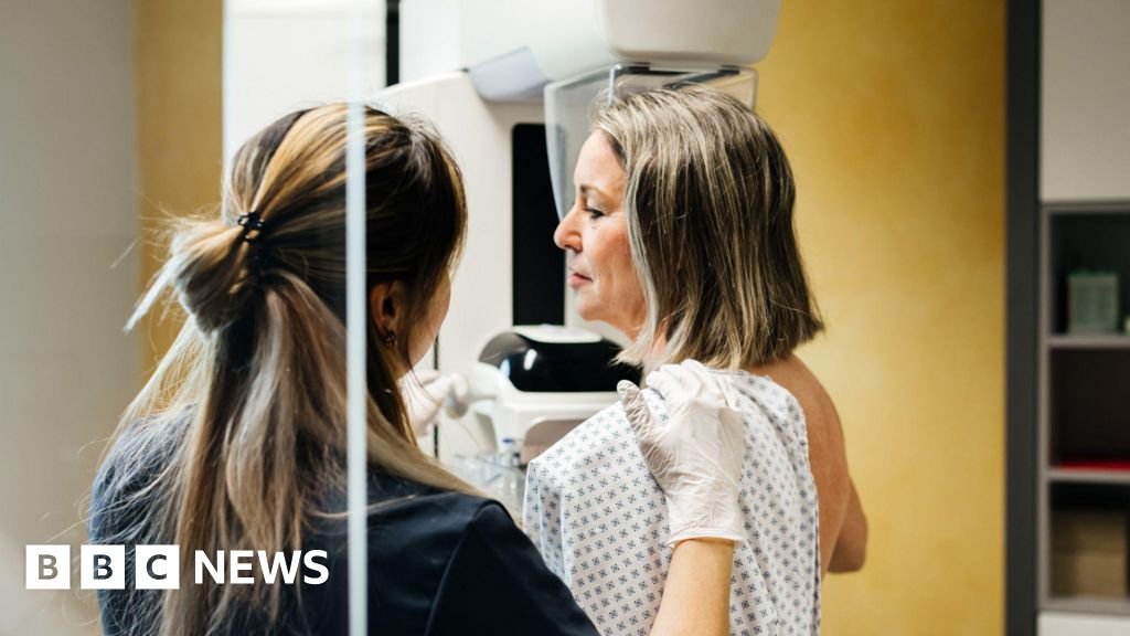 Millions of breast cancer patients could safely avoid chemotherapy, study suggests 4 Millions of breast cancer patients could safely avoid chemotherapy, study suggests