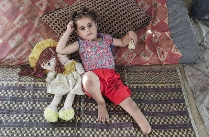 Gaza: 4-Year-Old Palestinian Girl Dreams of Playing and Running Again Despite Losing Her Leg 24 Inquilab 20260828 182326 0000 d 1