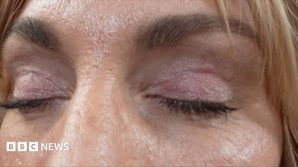 Watch: My eyelids became infected - I was scared to sleep 32 Watch: 'My eyelids became infected - I was scared to sleep'